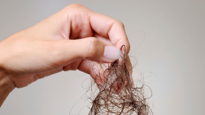 Suffocating Hairloss
