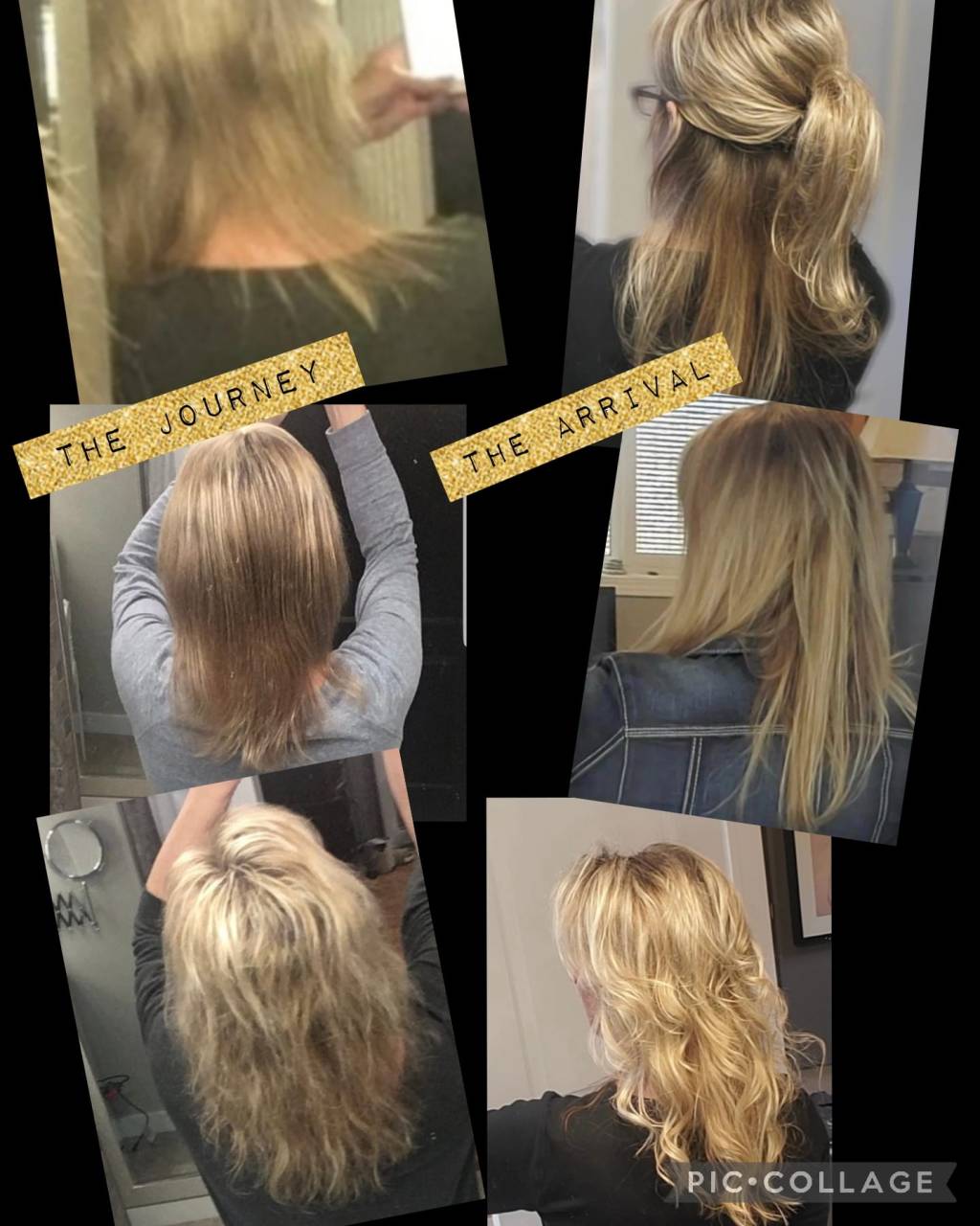 Understanding DHT Hair Loss and How To Reclaim Your&nbsp;Locks